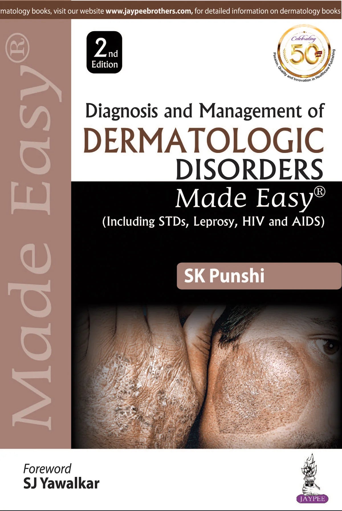 Diagnosis and Management of Dermatologic Disorders