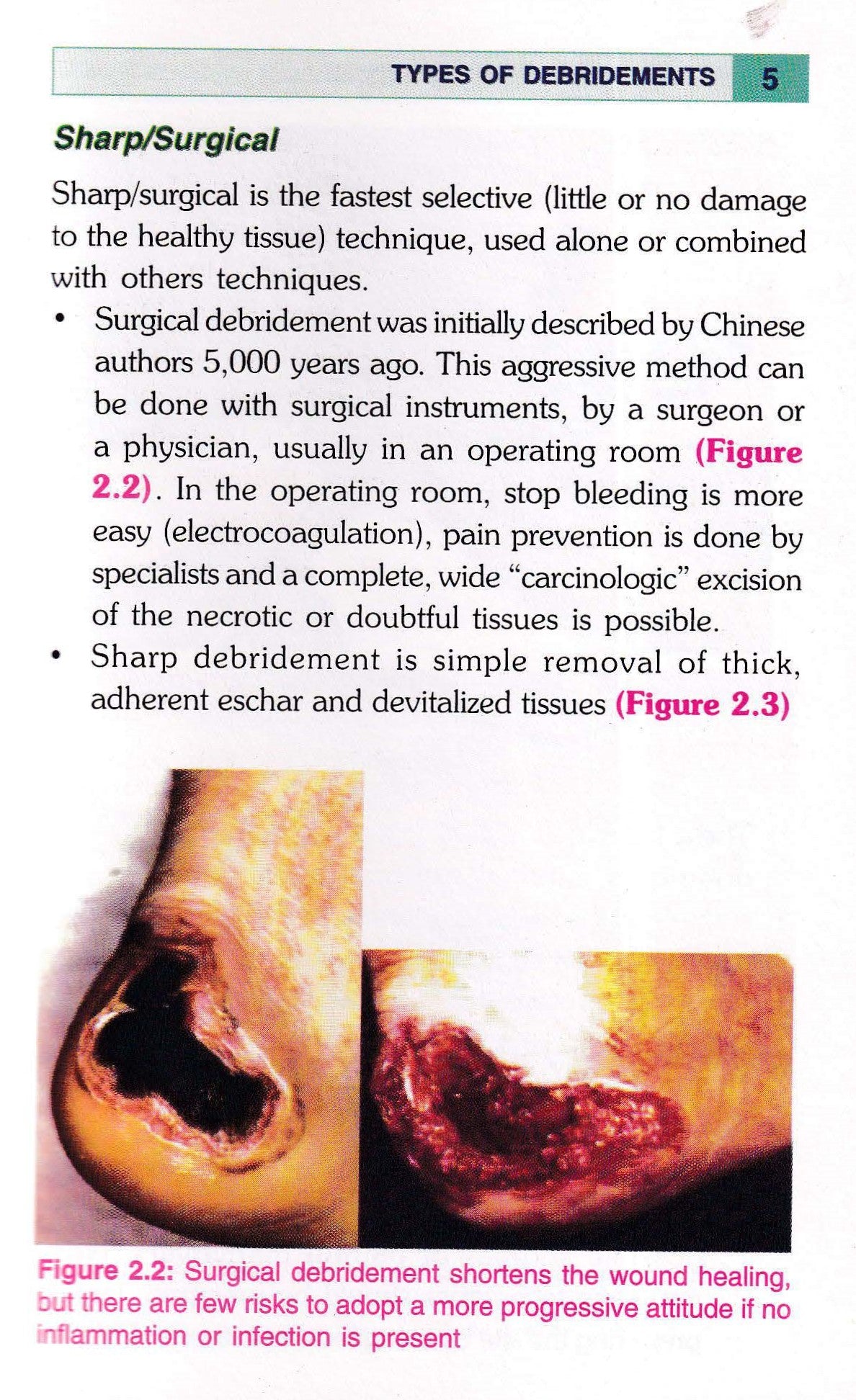 Step By Step Wound Healing With Cd-rom