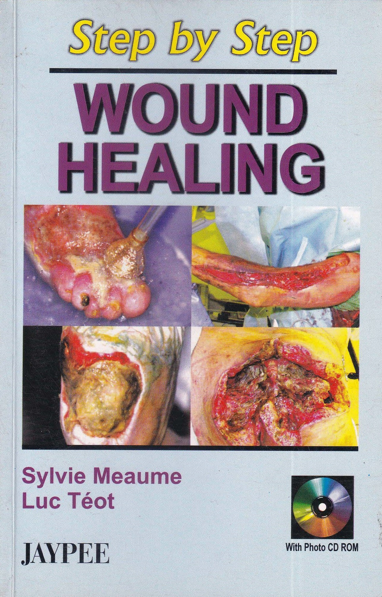 Step By Step Wound Healing With Cd-rom